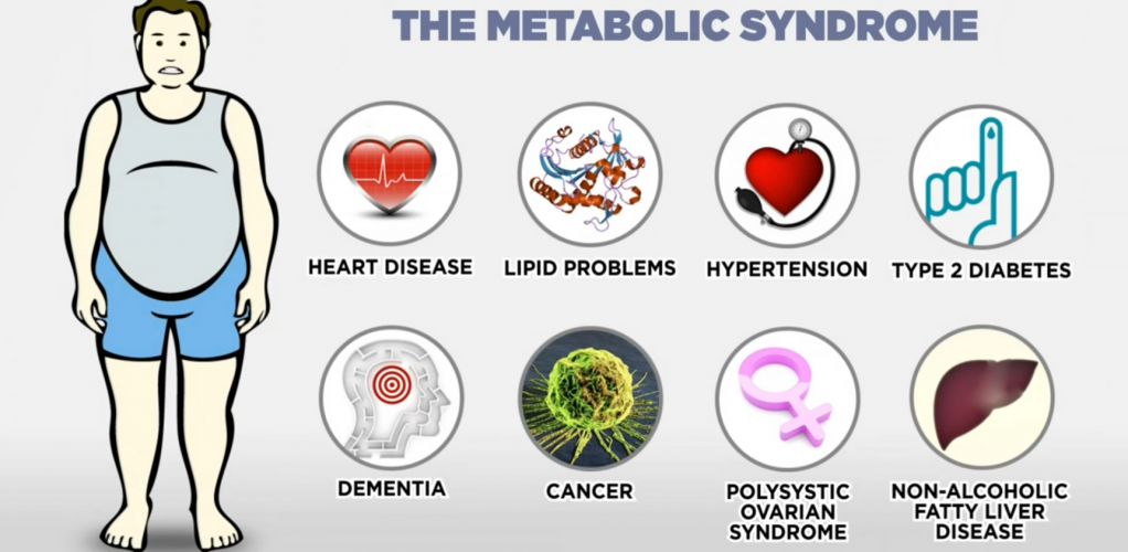 Mengenal Faktor Risiko Sindrom Metabolik Pada Orang Dewasa
