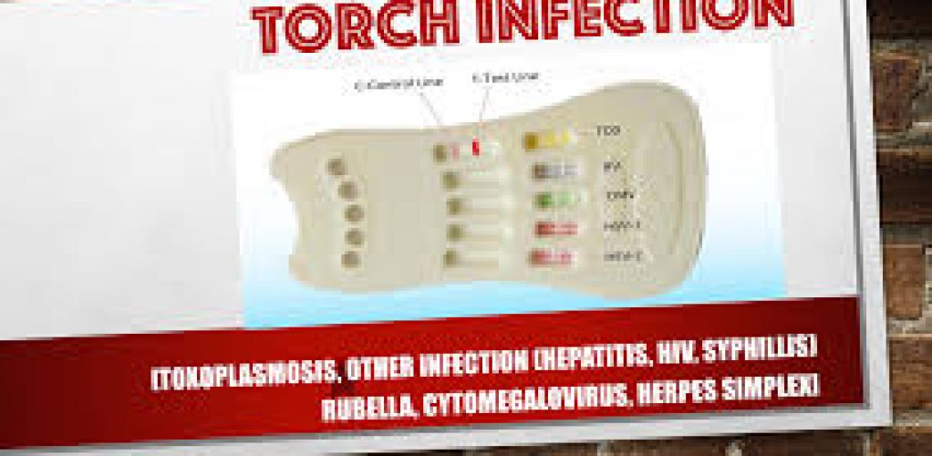 ROGRAM SKRINING DAN TERAPI TORCH PEMDA DIY